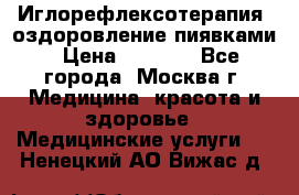 Иглорефлексотерапия, оздоровление пиявками › Цена ­ 3 000 - Все города, Москва г. Медицина, красота и здоровье » Медицинские услуги   . Ненецкий АО,Вижас д.